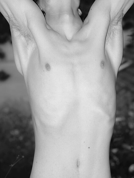 Männlicher Oberkörper © Benedikt Burger